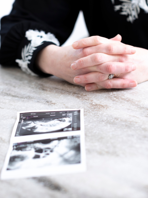 Patient with her ultrasound pictures in front of her on a desk