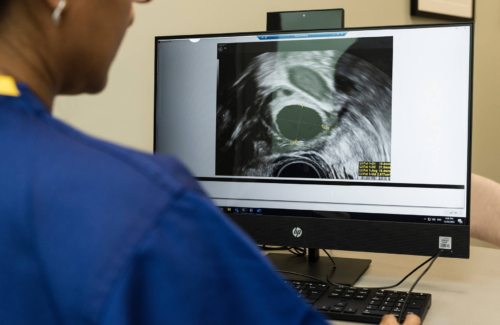 Clinician looking at an image of an ultrasound on a computer screen